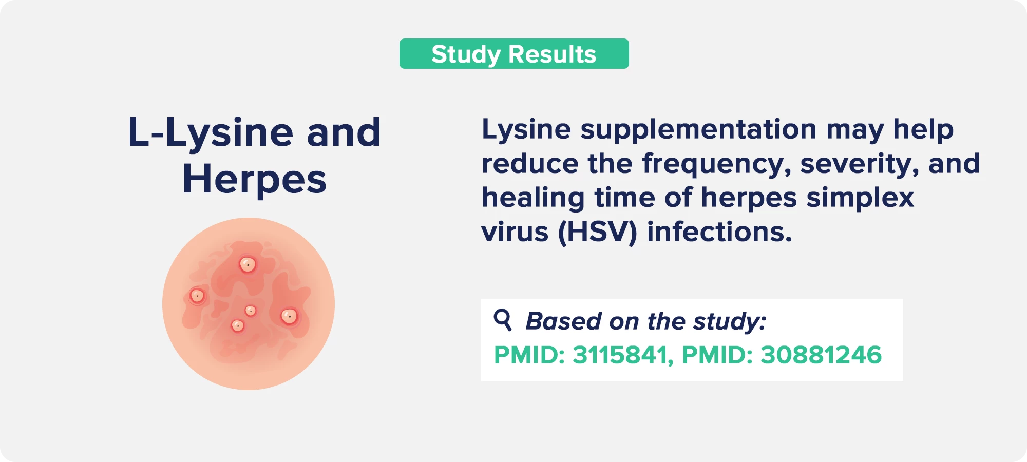 L-Lysine and Herpes