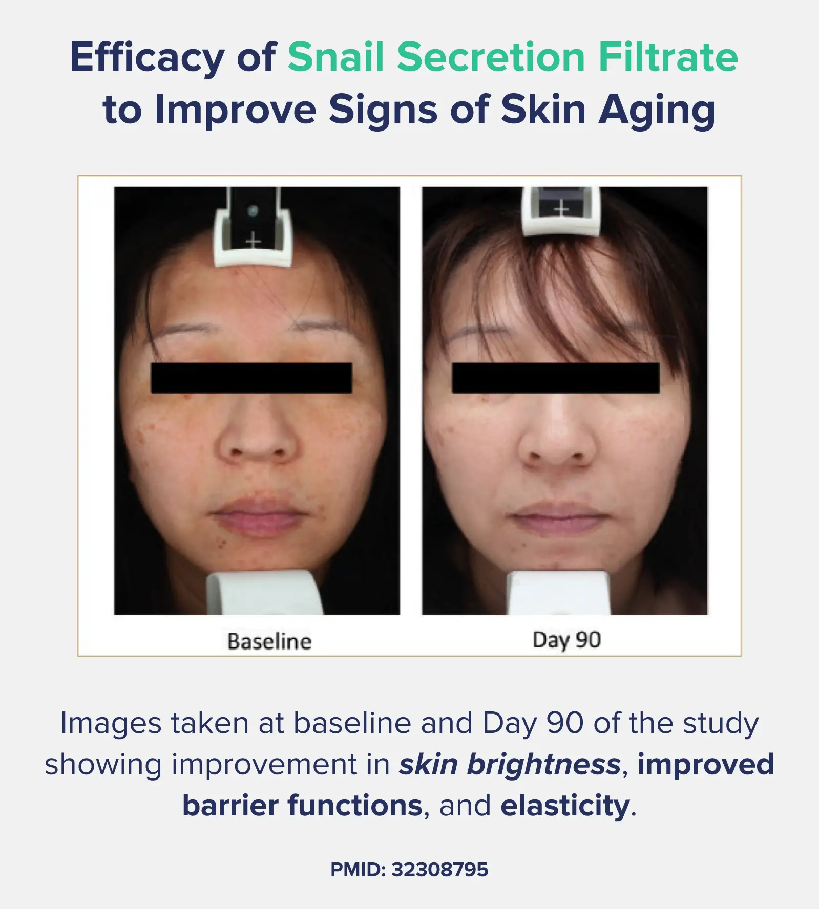 A graphic entitled "Efficacy of Snail Secretion Filtrate to Improve Signs of Skin Aging," depicting a pair of before-and-after images of a woman who took snail secretion filtrate for 90 days, along with a statement describing her results, which include skin brightness, elasticity, and more. 