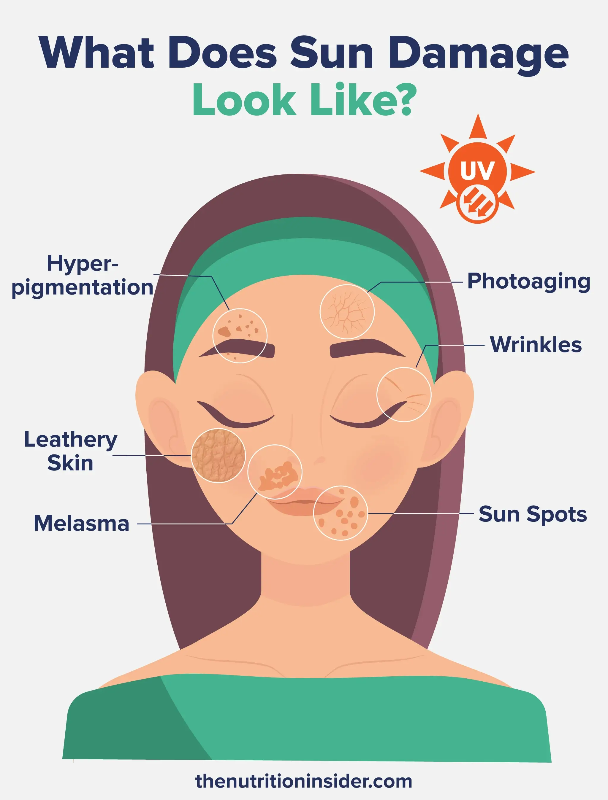 An infographic describing the symptoms of sun damage on skin.